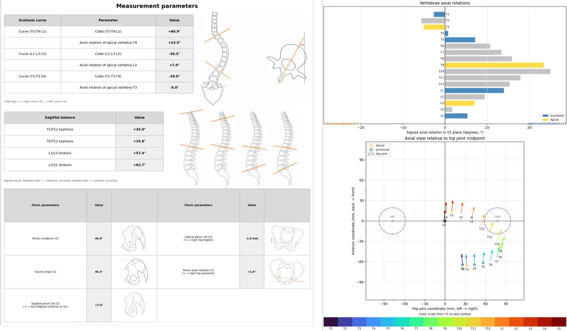 Charts of spine and pelvic measurement parameters