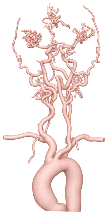 3D model of the head and neck arteries reconstructed from the CTA