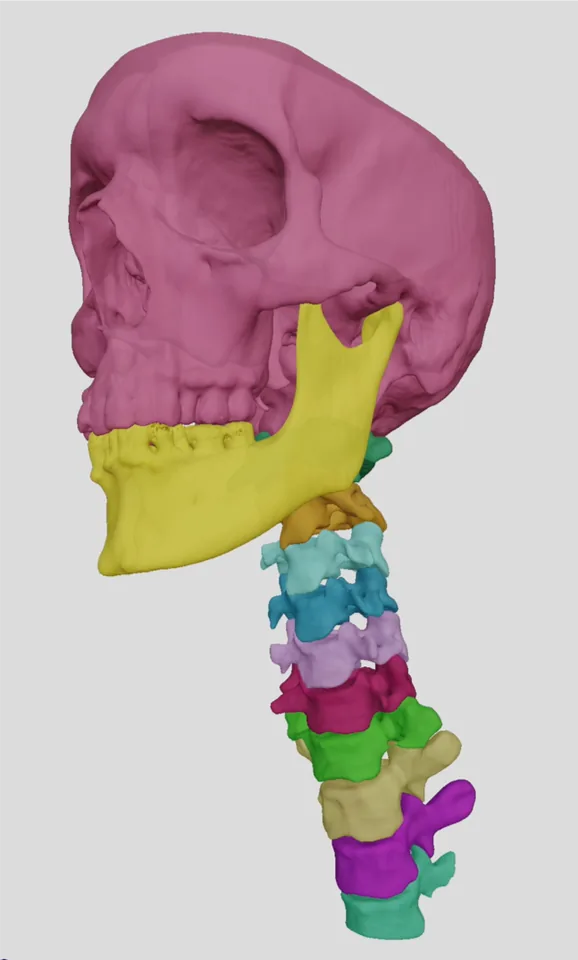 3D model of the skull and mandible